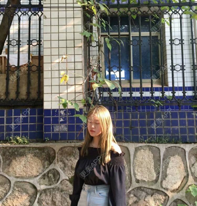 更美 - 更美用户wbJan4VHp8的眼皮下垂矫正经验 | 长沙 | 眼皮下垂矫正