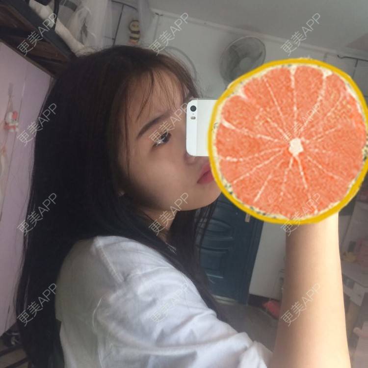 更美 - 更美用户wbJan4VHp8的眼皮下垂矫正经验 | 长沙 | 眼皮下垂矫正