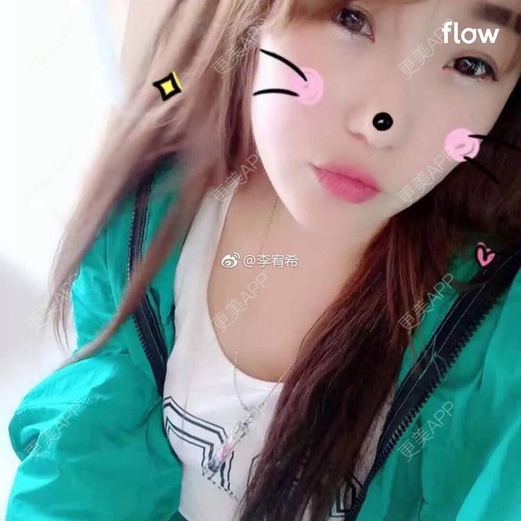 更美 - 彪悍女友哟🇹🇭的埋线双眼皮经验 | 胶原蛋白隆鼻 | 埋线双眼皮 | 开外眼角 | 玻尿酸卧蚕 | 除皱瘦脸