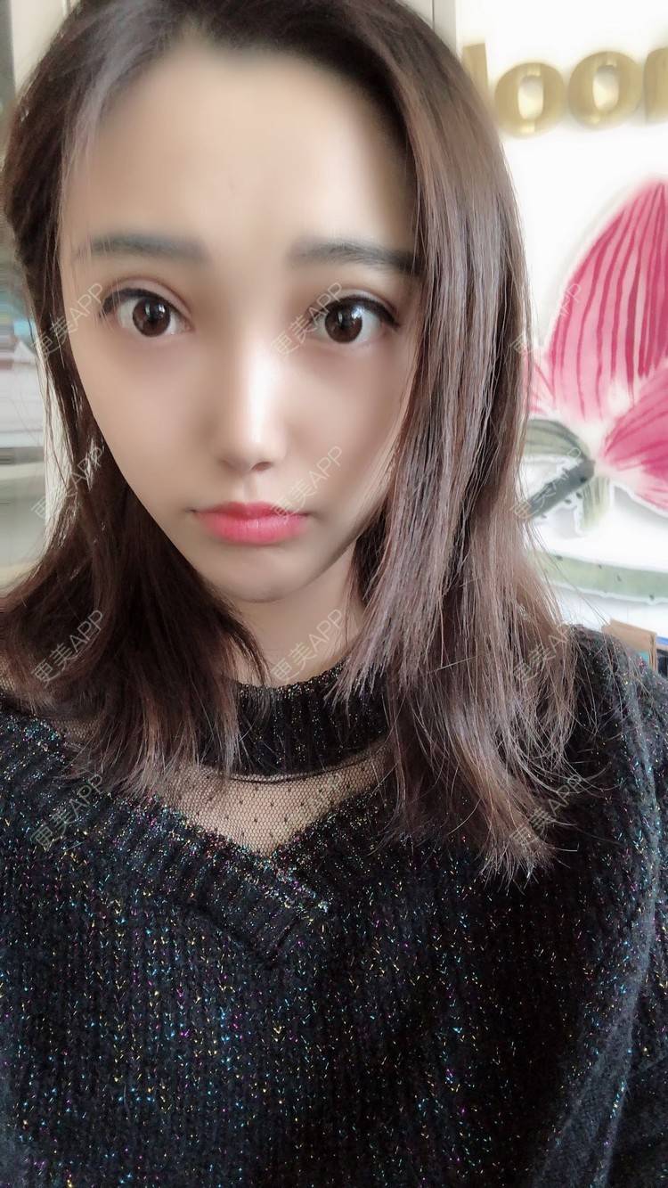 昙花一梦的双眼皮日记