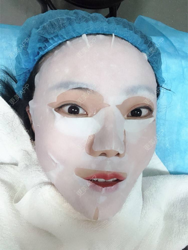 更美 - 更美用户HktsdssB56的牙贴面经验 | 牙齿瓷贴面 | 成都 | 牙贴面