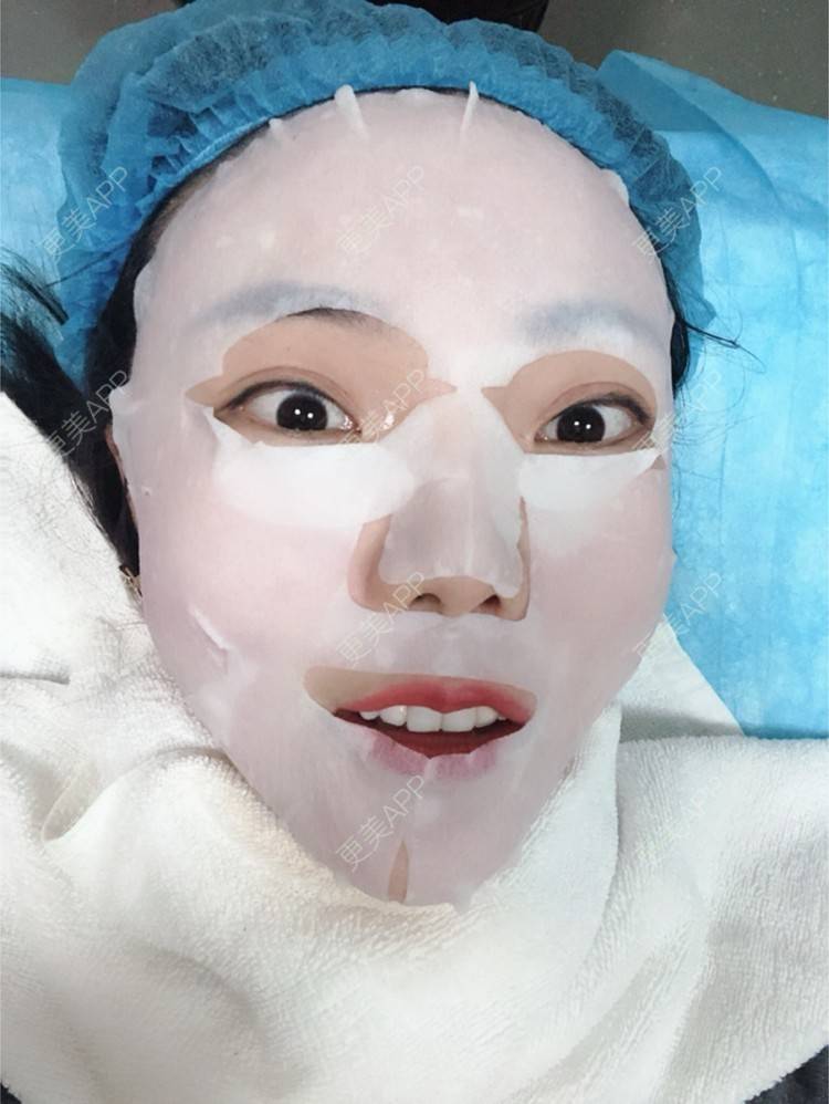 更美 - 更美用户HktsdssB56的牙贴面经验 | 牙齿瓷贴面 | 成都 | 牙贴面