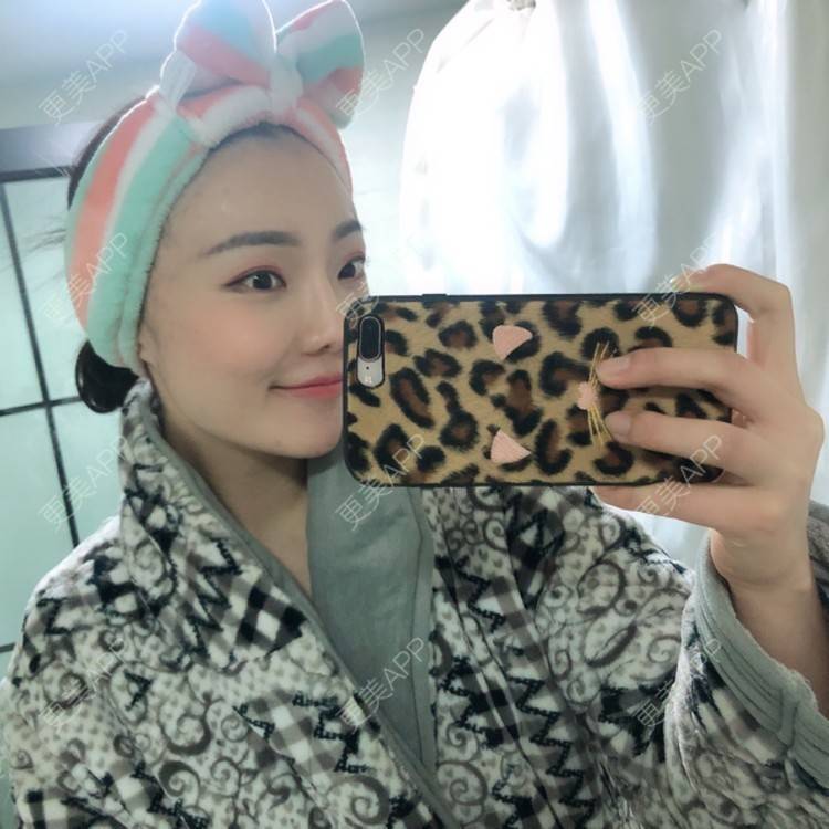 更美 - 更美用户HktsdssB56的牙贴面经验 | 牙齿瓷贴面 | 成都 | 牙贴面