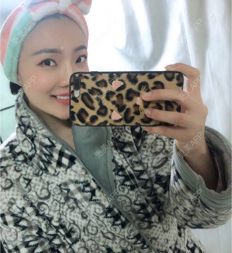 更美 - 更美用户HktsdssB56的牙贴面经验 | 牙齿瓷贴面 | 成都 | 牙贴面