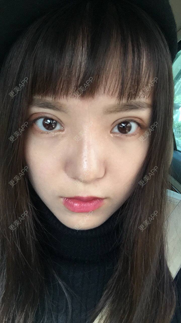 智慧小仙女的眼综合日记