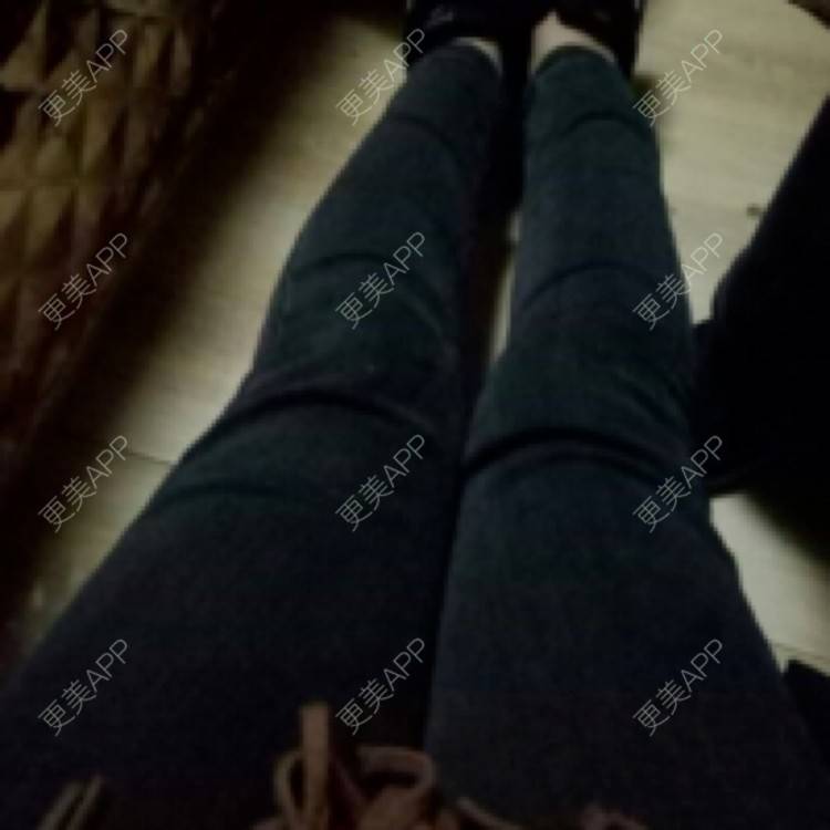更美 - 更美用户kfFP2Ku1YP的射频溶脂经验 | 注射溶脂瘦脸 | 假体丰臀 | 隆鼻 | 吸脂 | 玻尿酸 | 切眉 | 射频溶脂 | 私处漂红 | 除皱瘦脸 | 埋线提升 | 皮秒激光 | 上海