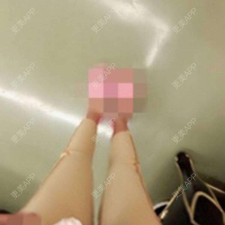 更美 - 更美用户kfFP2Ku1YP的射频溶脂经验 | 注射溶脂瘦脸 | 假体丰臀 | 隆鼻 | 吸脂 | 玻尿酸 | 切眉 | 射频溶脂 | 私处漂红 | 除皱瘦脸 | 埋线提升 | 皮秒激光 | 上海