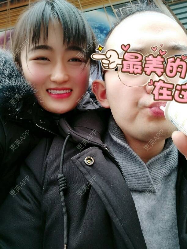 更美 - 淑芳宅_斋的玻尿酸鼻部经验 | 玻尿酸鼻部 | 鼻部多项 | 牙齿美白 | 玻尿酸 | 长沙