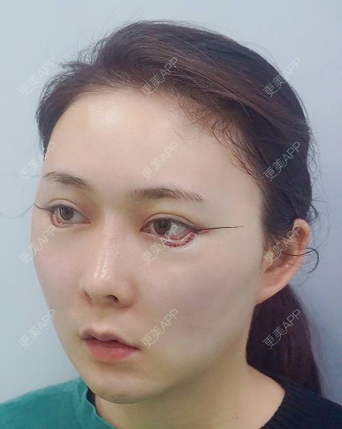 更美用户tdamrf1xkb的开外眼角日记