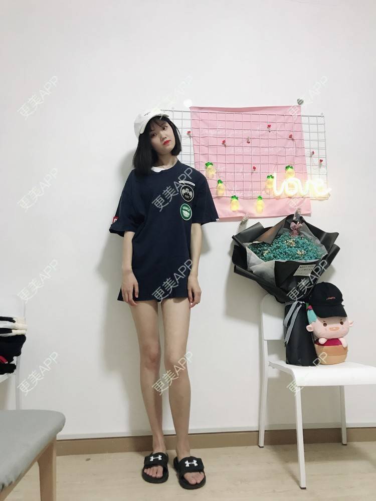 更美用户rmi8fsvxci的吸脂瘦大腿日记