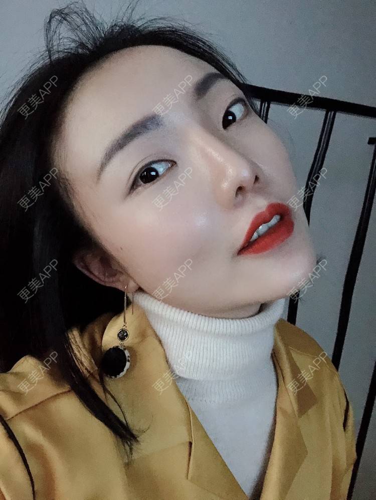 更美 - 更美用户HktsdssB56的牙贴面经验 | 成都 | 牙贴面 | 牙齿瓷贴面