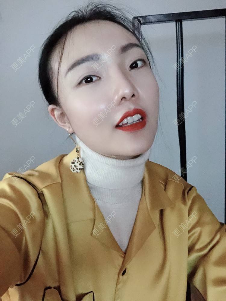 更美 - 更美用户HktsdssB56的牙贴面经验 | 成都 | 牙贴面 | 牙齿瓷贴面