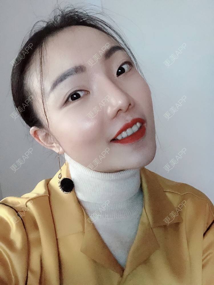 更美 - 更美用户HktsdssB56的牙贴面经验 | 成都 | 牙贴面 | 牙齿瓷贴面