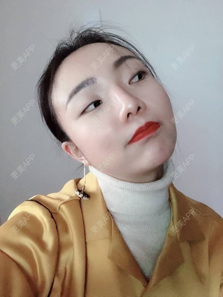 更美 - 更美用户HktsdssB56的牙贴面经验 | 成都 | 牙贴面 | 牙齿瓷贴面