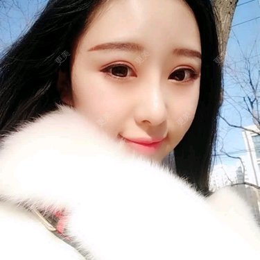 【北京@谢立宁】吸脂瘦脸