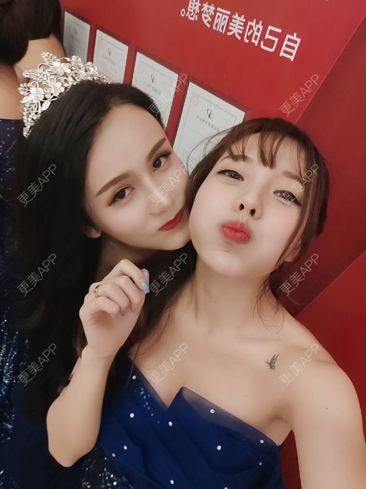 更美 - 邓晧畇 医生的假体隆胸经验 | 假体隆胸 | 南宁