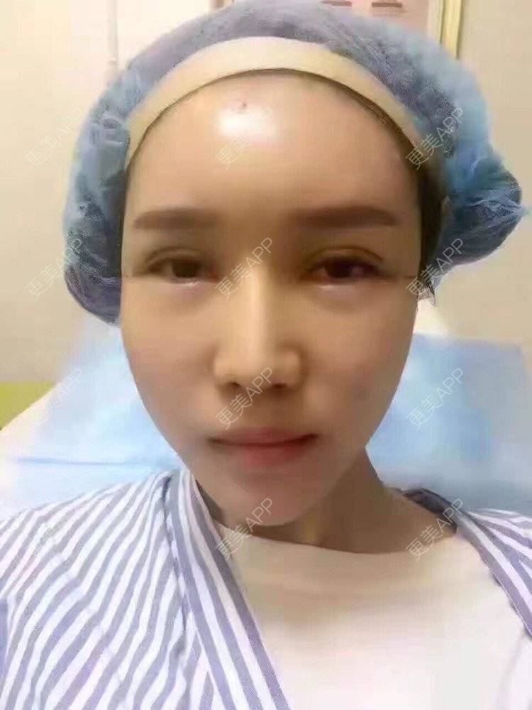 更美 - 祢的美丽/我的职责的全切双眼皮经验 | 肋软骨隆鼻 | 全切双眼皮 | 开内眼角 | 开外眼角 | 内切去眼袋 | 上海