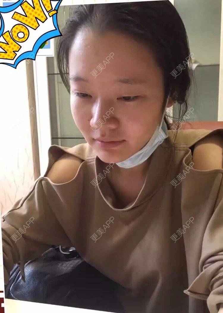 更美 - 祢的美丽/我的职责的全切双眼皮经验 | 肋软骨隆鼻 | 全切双眼皮 | 开内眼角 | 开外眼角 | 内切去眼袋 | 上海