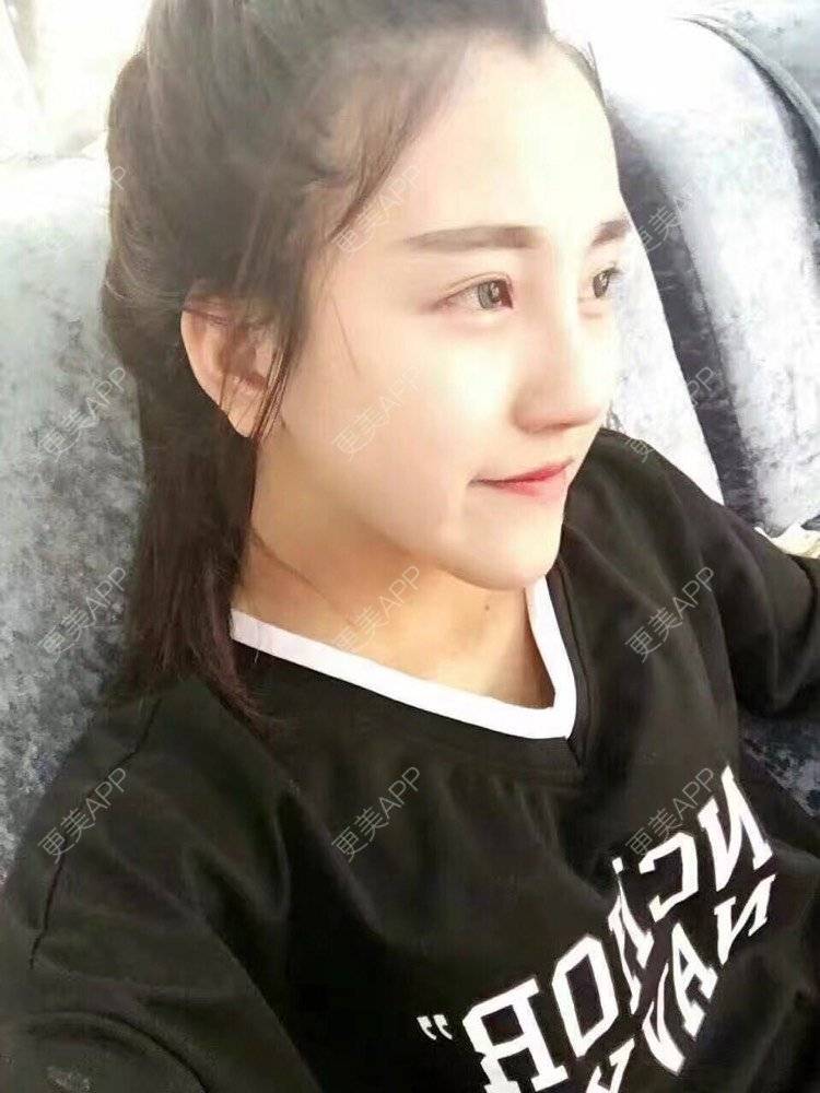 更美 - 祢的美丽/我的职责的全切双眼皮经验 | 肋软骨隆鼻 | 全切双眼皮 | 开内眼角 | 开外眼角 | 内切去眼袋 | 上海