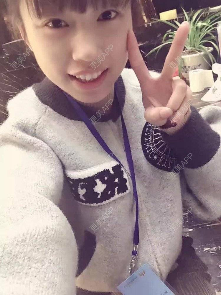 更美 - 祢的美丽/我的职责的全切双眼皮经验 | 肋软骨隆鼻 | 全切双眼皮 | 开内眼角 | 开外眼角 | 内切去眼袋 | 上海