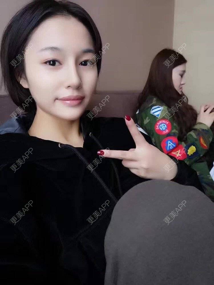 更美 - 祢的美丽/我的职责的全切双眼皮经验 | 肋软骨隆鼻 | 全切双眼皮 | 开内眼角 | 开外眼角 | 内切去眼袋 | 上海