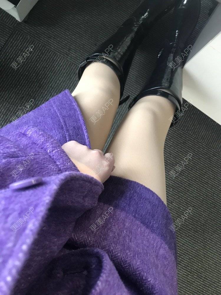 更美 - 请叫我小花的吸脂瘦大腿经验 | 吸脂瘦大腿 | 北京