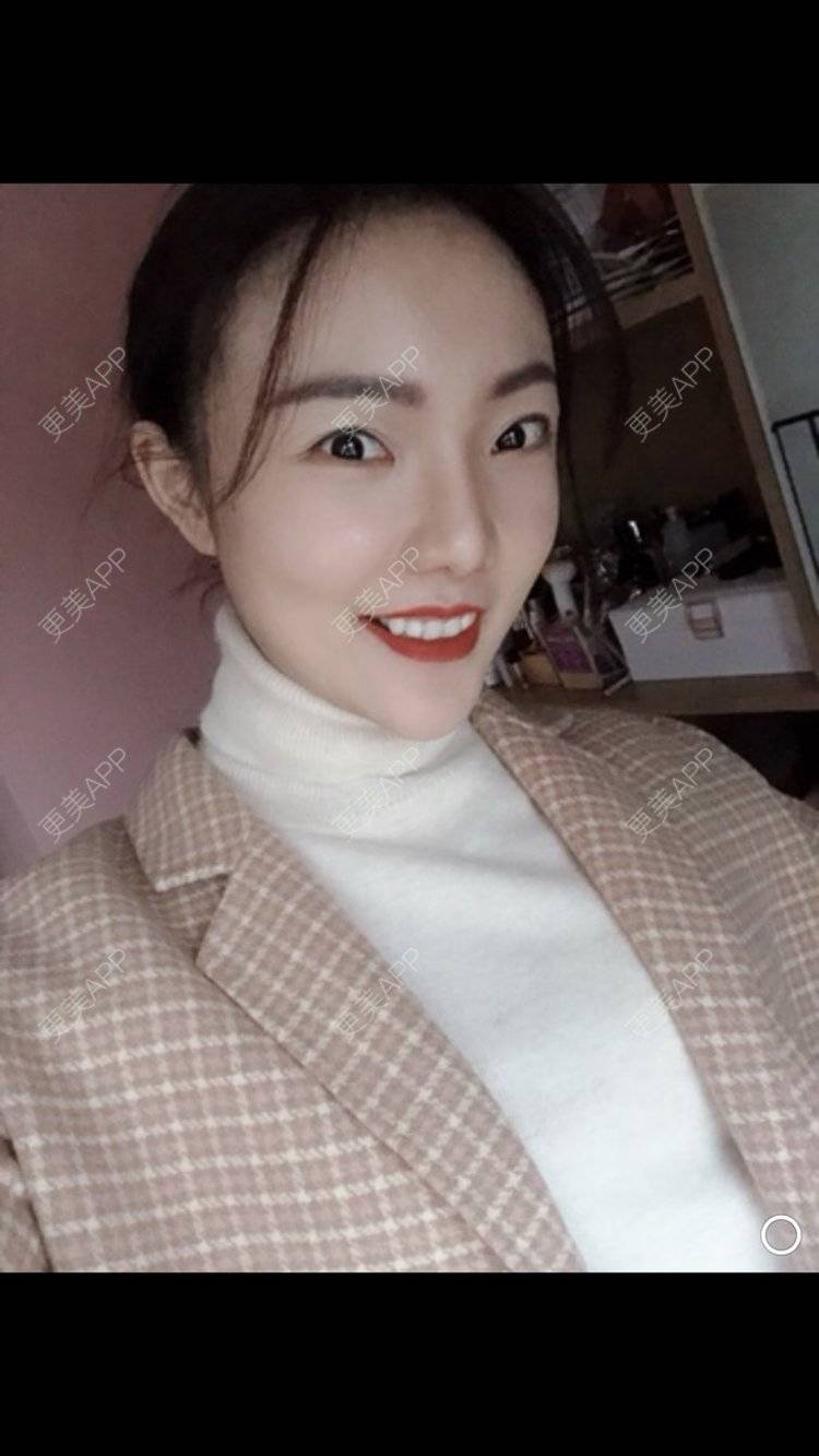 更美 - 更美用户HktsdssB56的牙贴面经验 | 牙齿瓷贴面 | 成都 | 牙贴面