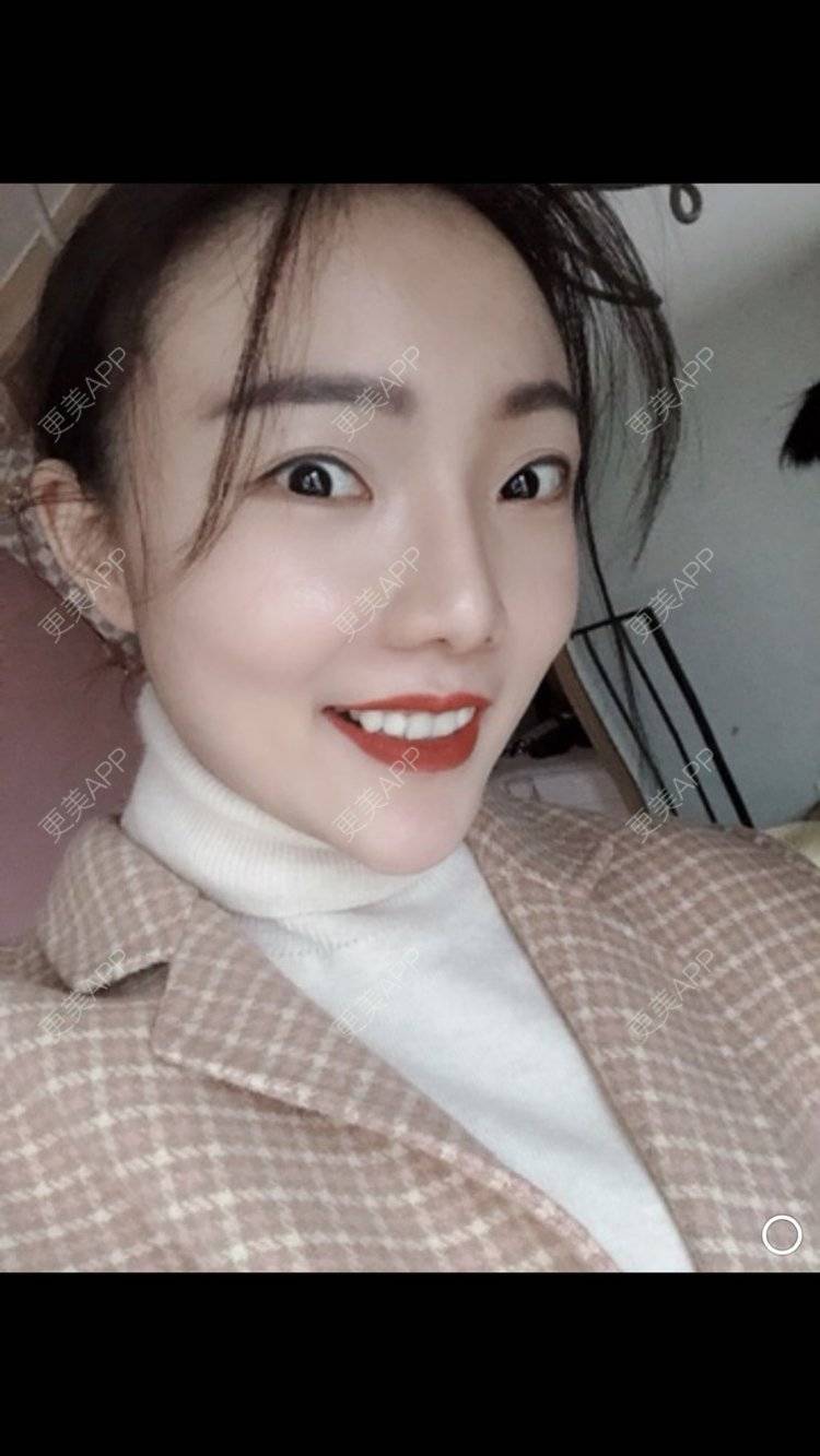 更美 - 更美用户HktsdssB56的牙贴面经验 | 牙齿瓷贴面 | 成都 | 牙贴面