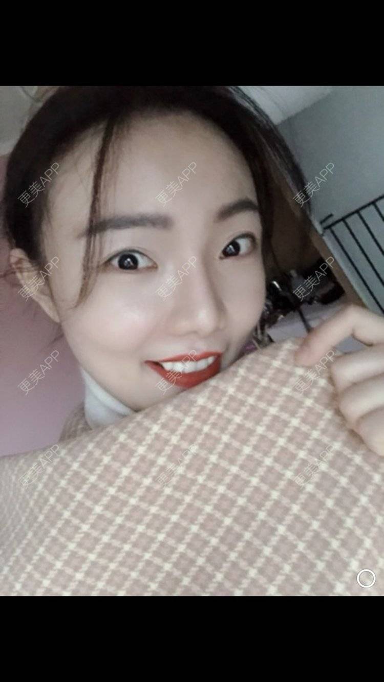 更美 - 更美用户HktsdssB56的牙贴面经验 | 牙齿瓷贴面 | 成都 | 牙贴面