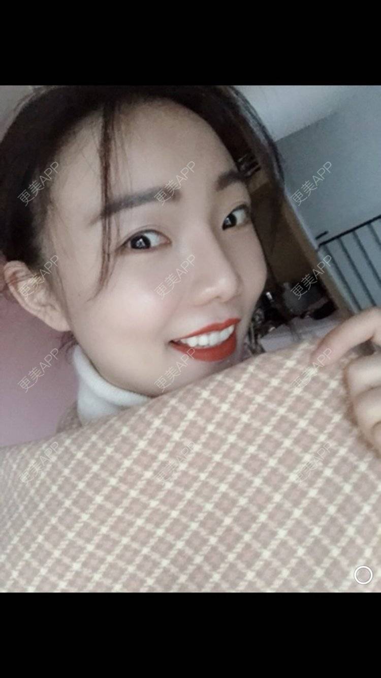 更美 - 更美用户HktsdssB56的牙贴面经验 | 牙齿瓷贴面 | 成都 | 牙贴面