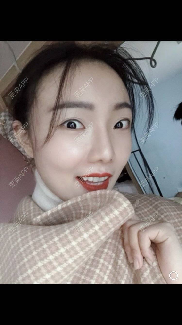 更美 - 更美用户HktsdssB56的牙贴面经验 | 牙齿瓷贴面 | 成都 | 牙贴面