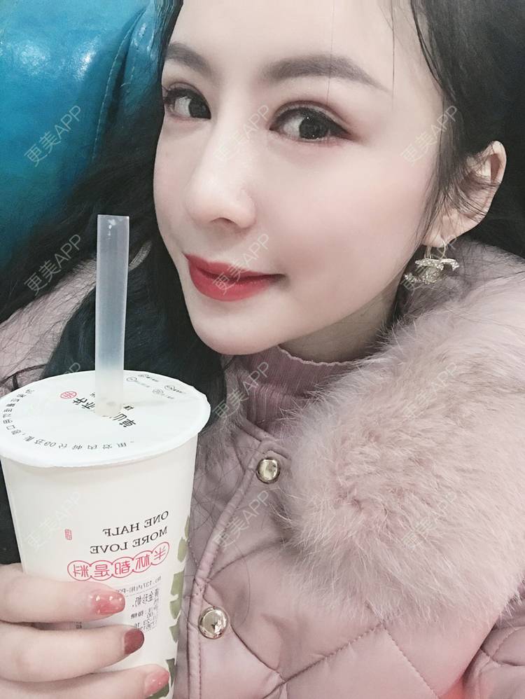 更美 - 卡门小妖精，的玻尿酸卧蚕经验 | 玻尿酸卧蚕 | 重庆 | 自体脂肪丰卧蚕 | 真皮丰卧蚕 | 双眼皮修复 | 眼部多项