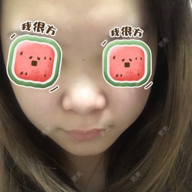 鼻翼
