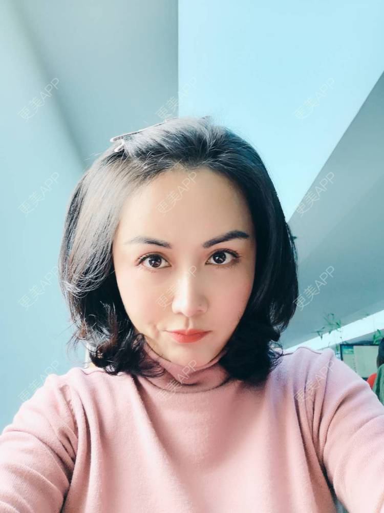 更美 - 瘦不了肿么办的自体脂肪全面部填充经验 | 自体脂肪丰额头 | 自体脂肪丰面颊 | 自体脂肪丰苹果肌 | 自体脂肪填充泪沟 | 丰胸（隆胸） | 自体脂肪垫下巴 | 自体脂肪丰太阳穴 | 假体隆胸 | 自体脂肪隆胸 | 重庆 | 自体脂肪全面部填充