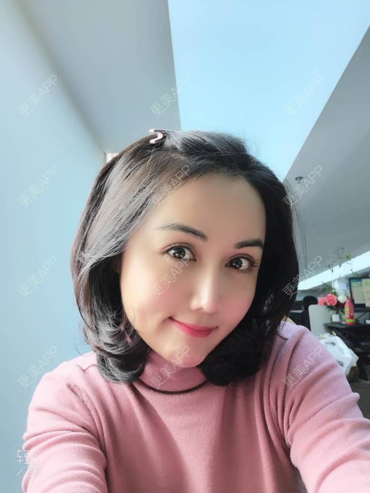 更美 - 瘦不了肿么办的自体脂肪全面部填充经验 | 自体脂肪丰额头 | 自体脂肪丰面颊 | 自体脂肪丰苹果肌 | 自体脂肪填充泪沟 | 丰胸（隆胸） | 自体脂肪垫下巴 | 自体脂肪丰太阳穴 | 假体隆胸 | 自体脂肪隆胸 | 重庆 | 自体脂肪全面部填充