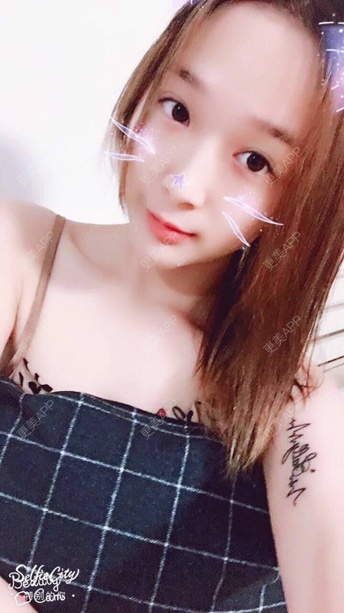 更美 - 更美用户lCgZFpup1y的人工骨垫下巴经验 | 人工骨垫下巴 | 上海