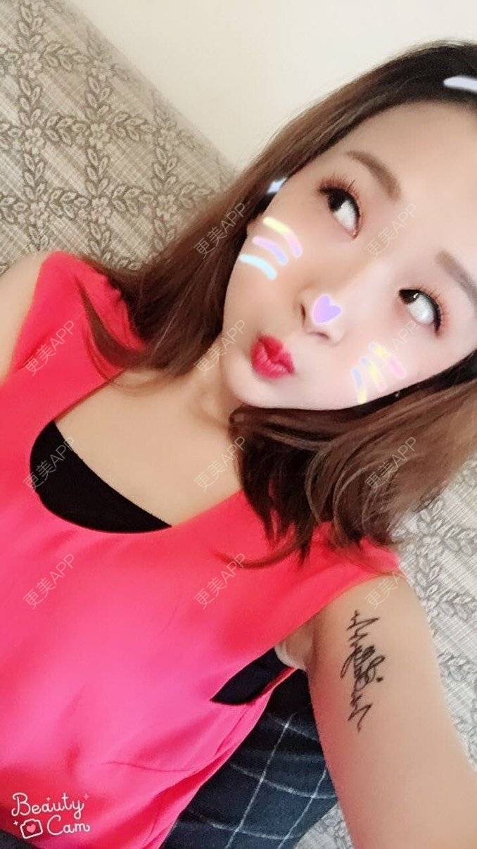 更美 - 更美用户lCgZFpup1y的人工骨垫下巴经验 | 人工骨垫下巴 | 上海