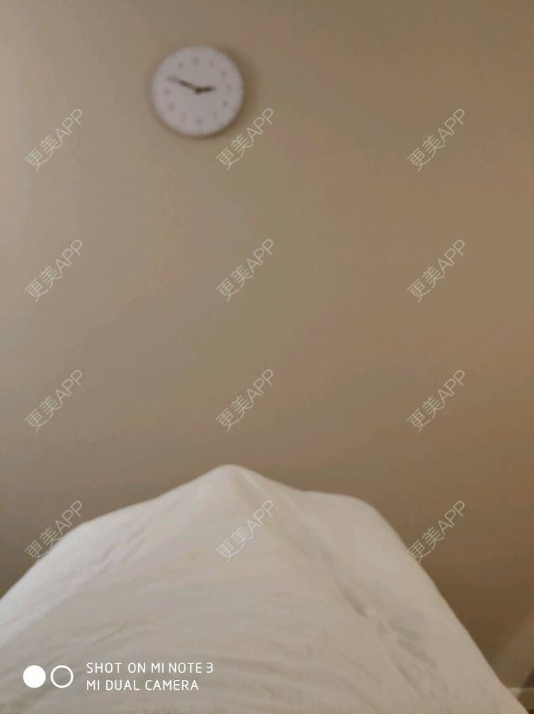 更美 - 大人.o的水光项目经验 | 成都 | 自体脂肪面部填充 | 水光项目 | 北京 | 深圳 | 下颌角 | 隆鼻 | 南京 | 假体隆胸 | 除皱瘦脸 | 长沙 | 牙贴面 | 玻尿酸 | 吸脂 | 东莞 | 鼻部综合