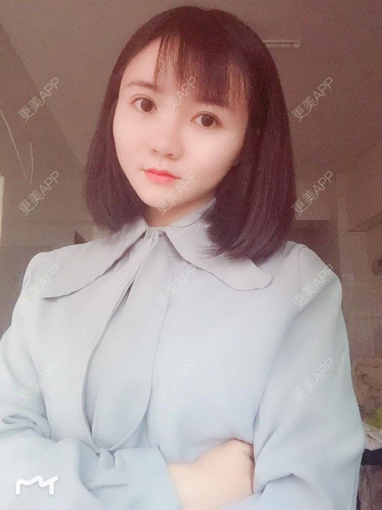 更美 - fhrhjtjth的近视矫正经验 | 深圳 | 近视矫正