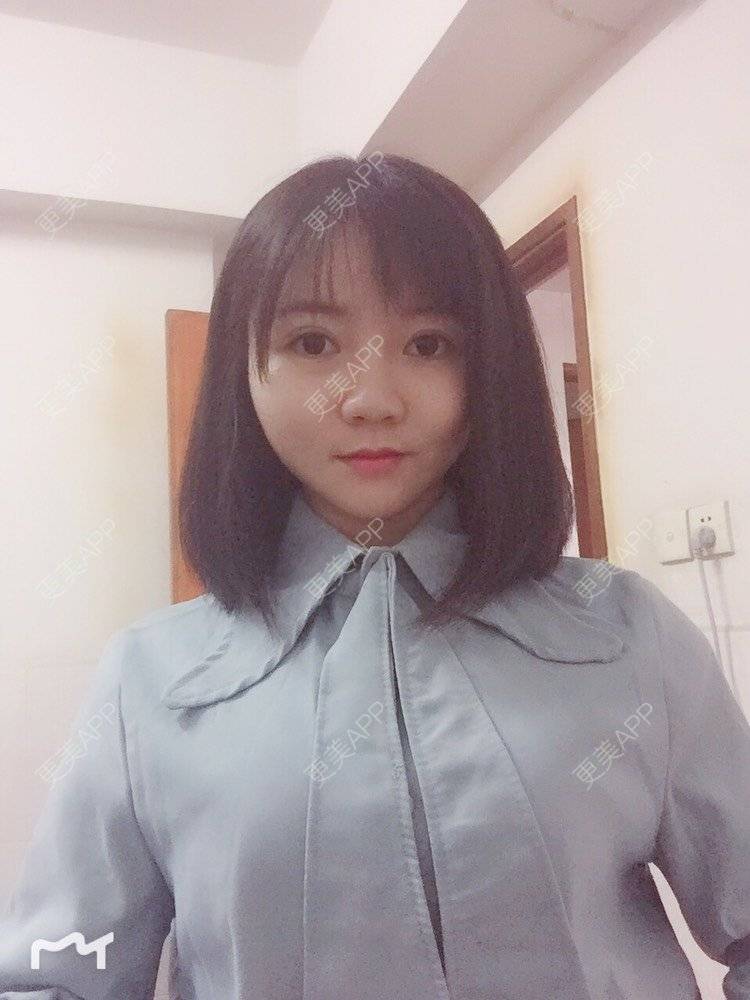 更美 - fhrhjtjth的近视矫正经验 | 深圳 | 近视矫正