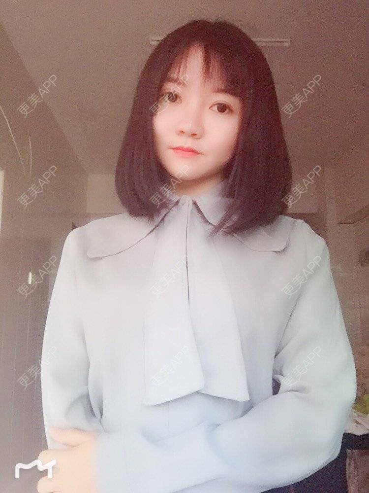 更美 - fhrhjtjth的近视矫正经验 | 深圳 | 近视矫正