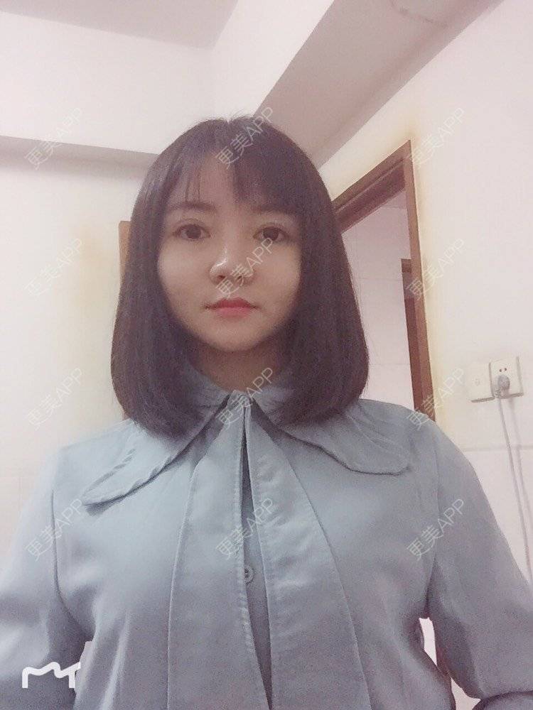 更美 - fhrhjtjth的近视矫正经验 | 深圳 | 近视矫正