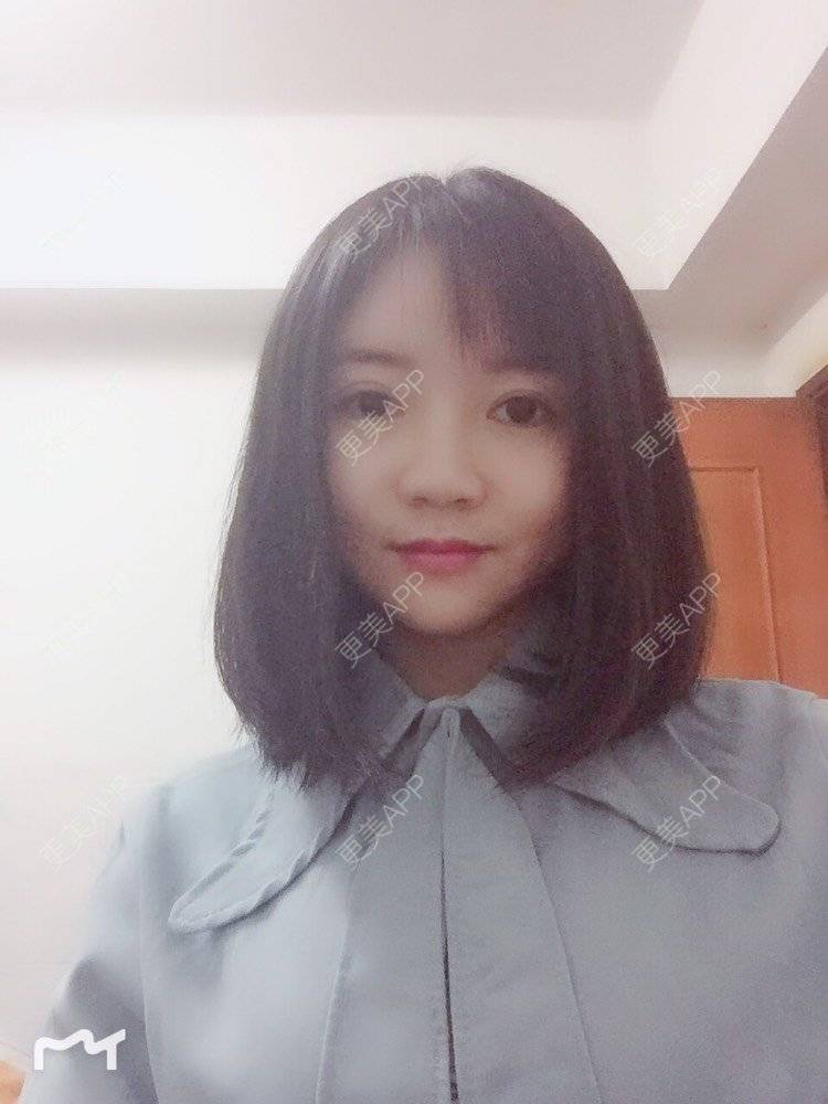 更美 - fhrhjtjth的近视矫正经验 | 深圳 | 近视矫正