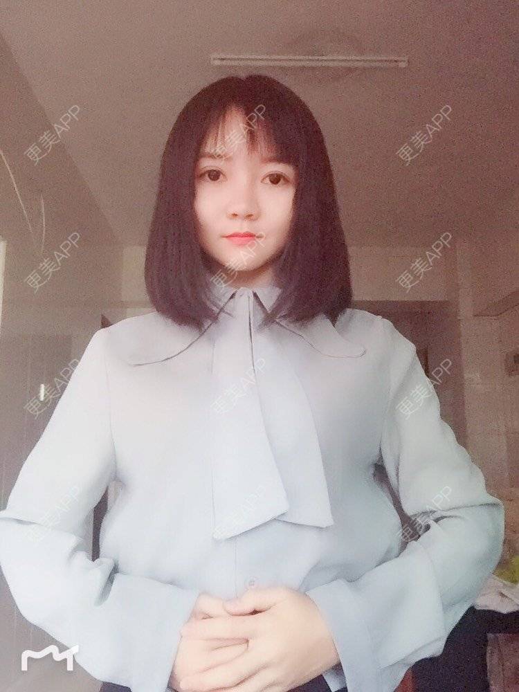 更美 - fhrhjtjth的近视矫正经验 | 深圳 | 近视矫正