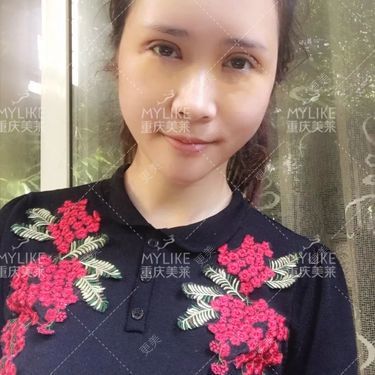 重庆美莱整形美容医院