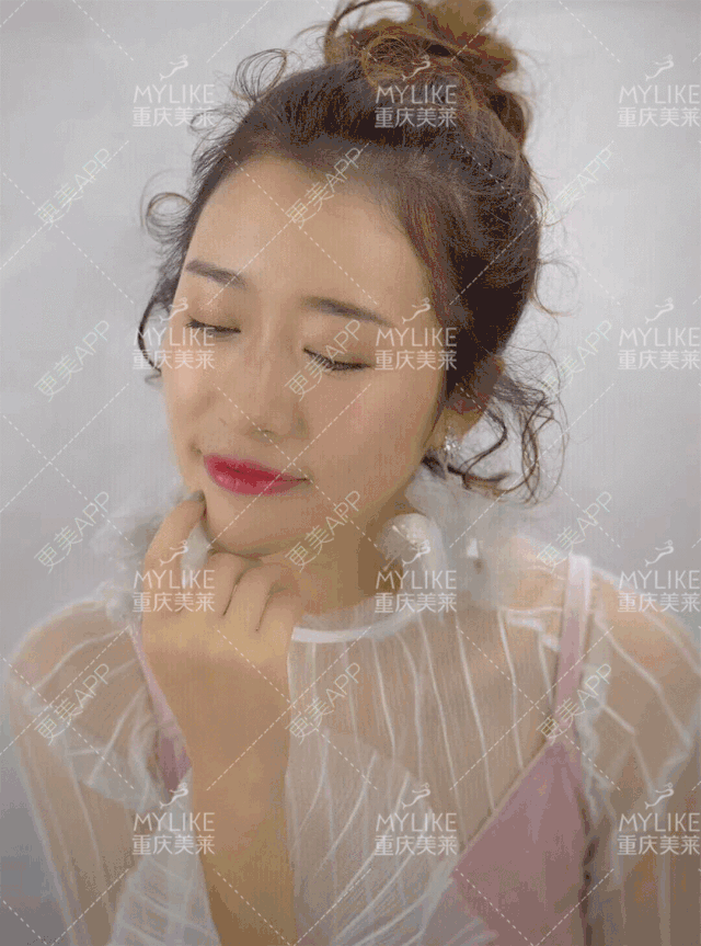 更美 - 重庆美莱整形美容医院的祛眼袋经验 | 祛眼袋