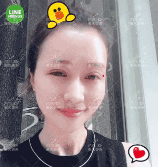 更美 - 重庆美莱整形美容医院的祛眼袋经验 | 祛眼袋