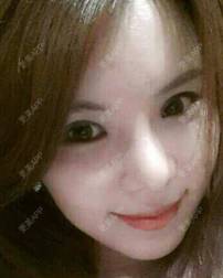 更美 - 更美用户ejJuxMDpUo的膨体隆鼻经验 | 膨体隆鼻 | 莆田