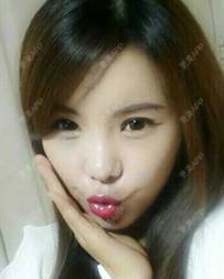 更美 - 更美用户ejJuxMDpUo的膨体隆鼻经验 | 膨体隆鼻 | 莆田