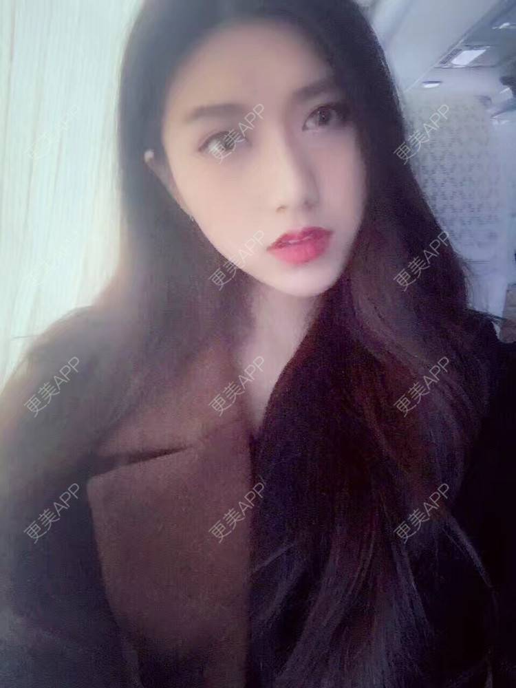 更美 - 更美用户ZXEbAlpKTV的双下巴溶脂经验 | 双下巴溶脂